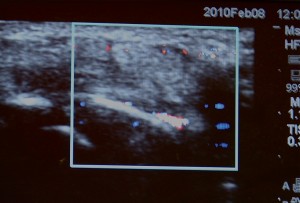 IMG_2942_2